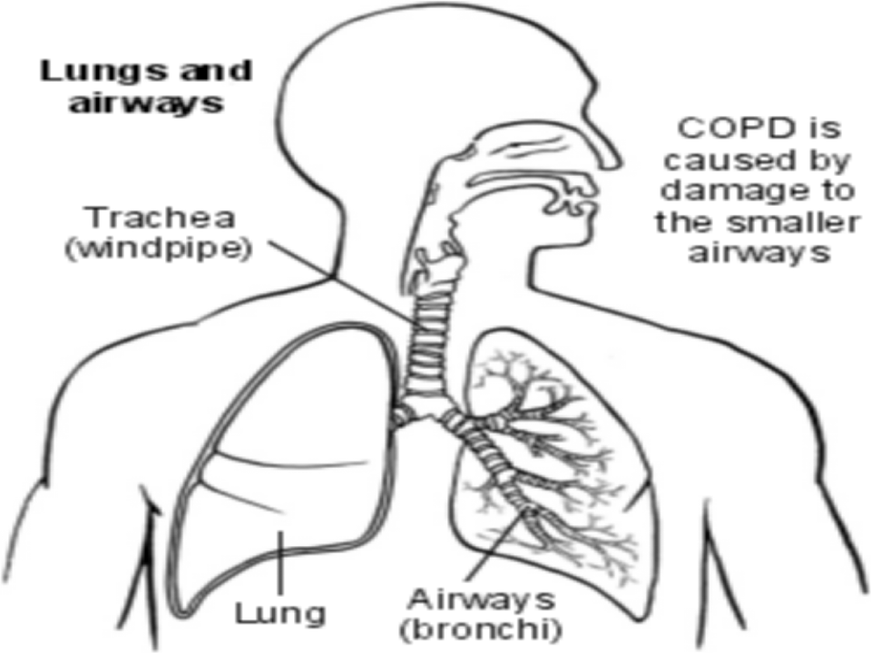 呼吸内科-COPD、慢性支气管炎.ppt 第4页
