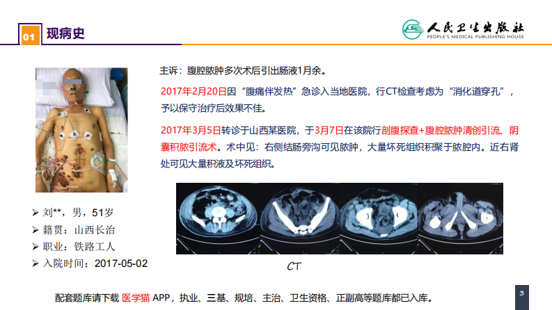 第十一章 案例分析-肠瘘、腹腔感染合并脓毒症.pdf 第3页