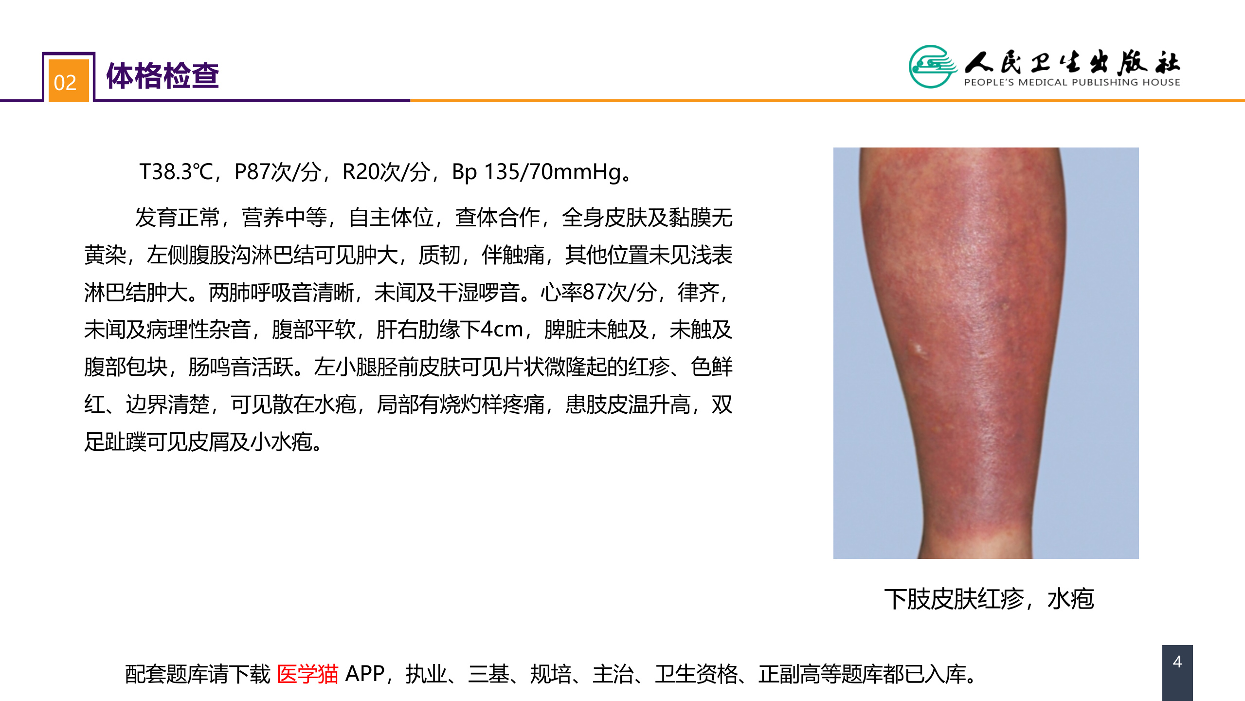 第十一章 案例分析-丹毒 .pptx 第4页