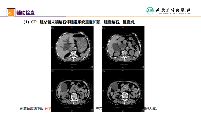 第四十四章 急腹症的诊断与鉴别诊断 案例分析-胆管炎.pdf 第5页