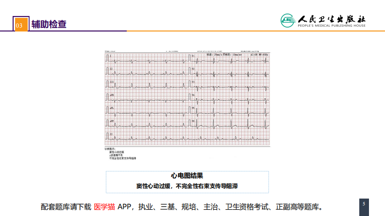 第二十九章 心脏疾病 案例分析-房间隔缺损.pdf 第5页