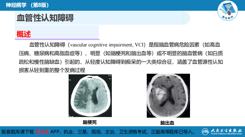 第九章 脑血管疾病（5）.pdf 第4页
