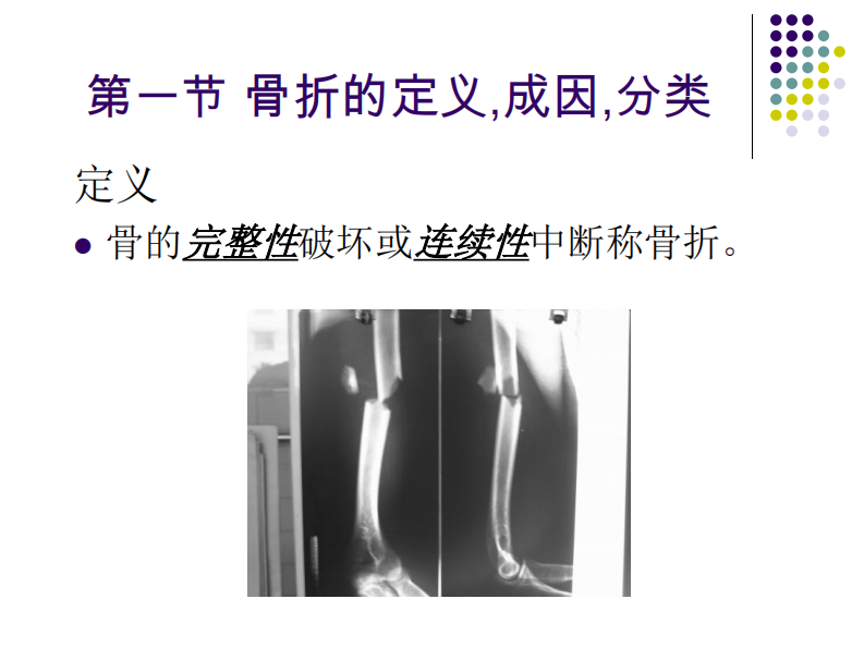 骨科-骨折总论-.pdf 第5页