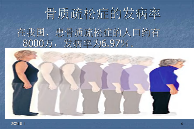 骨科-骨质疏松症ppt.pdf 第4页