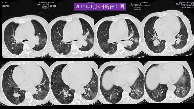 胸部影像解读：心肺一体性疾病.pdf 第5页