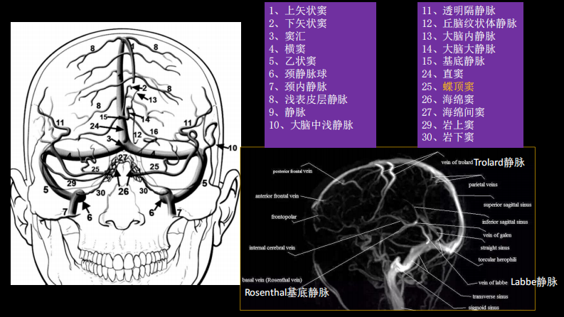 脑静脉血栓形成影像学.pdf 第5页