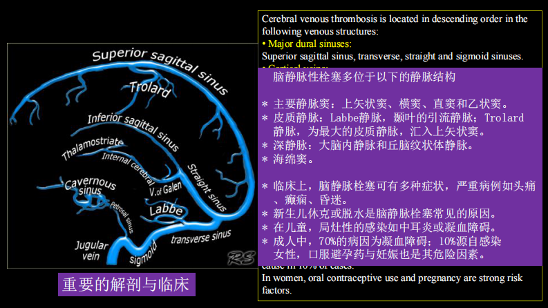 脑静脉血栓形成影像学.pdf 第3页