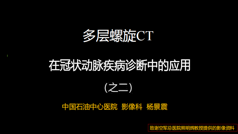 多层螺旋CT冠状动脉疾病诊断再学习之二.pdf 第1页