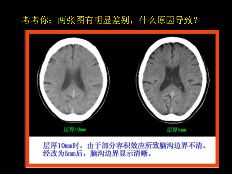 影像报告书写.pdf 第5页