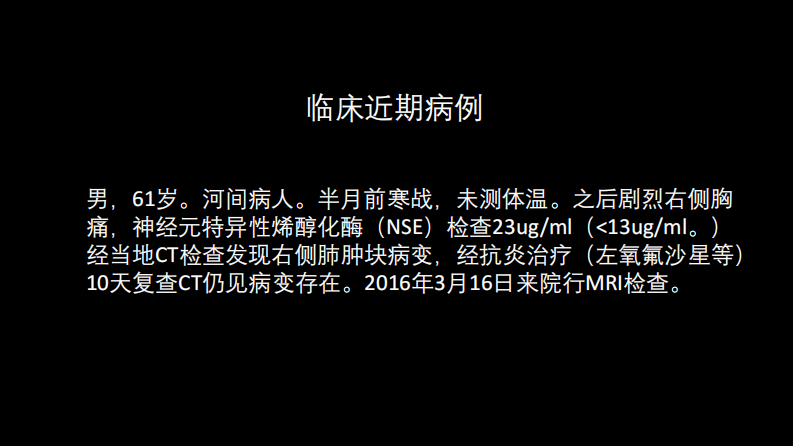 肺部肿块有效的影像检查选择.pdf 第3页