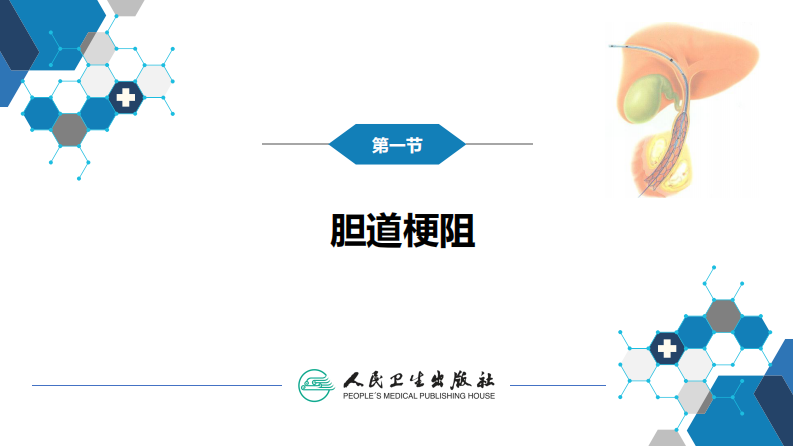 第十四章 非血管疾病介入治疗.pdf 第5页