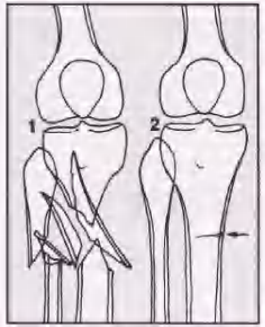 实用骨折治疗学（美）（全图版）.pdf 第1页