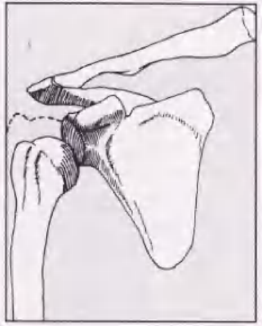 实用骨折治疗学（美）（全图版）.pdf 第5页