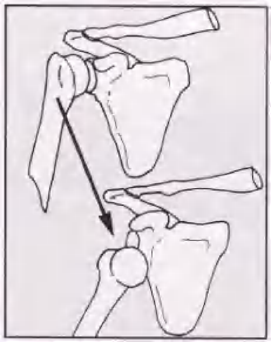 实用骨折治疗学（美）（全图版）.pdf 第4页