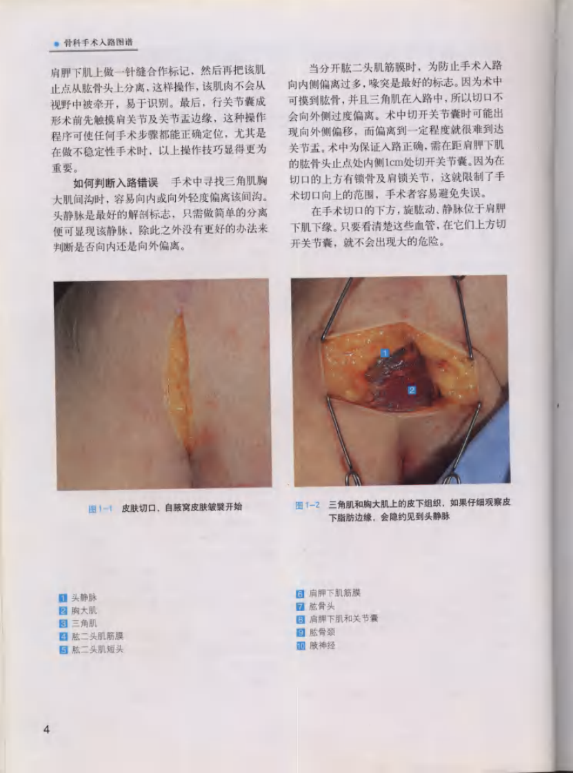 骨科手术入路图谱（中文高清彩图版）.pdf 第4页