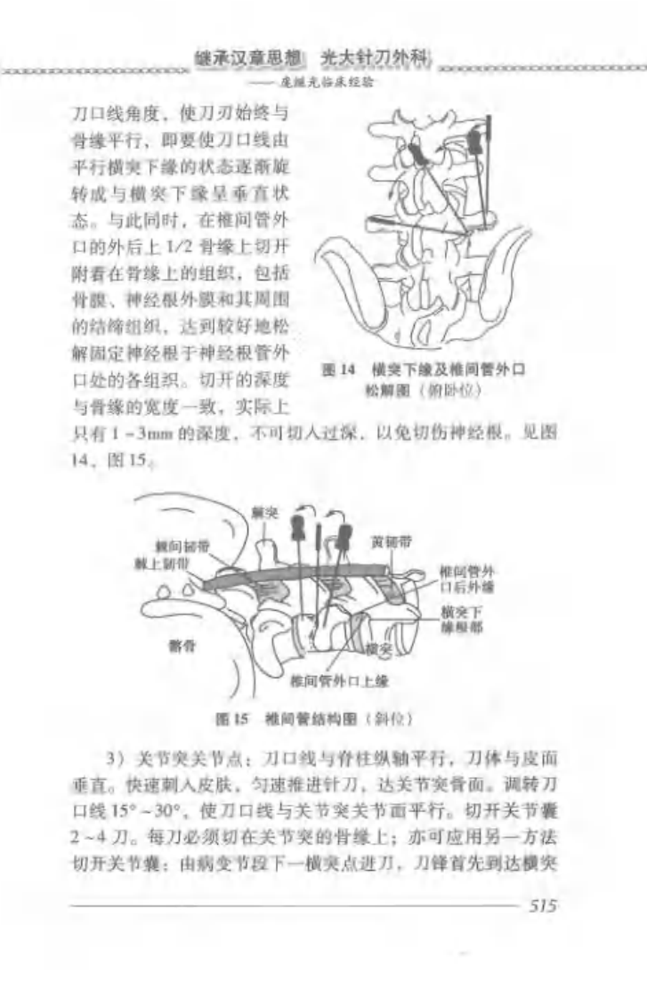 中国针刀临证精要09.pdf 第3页