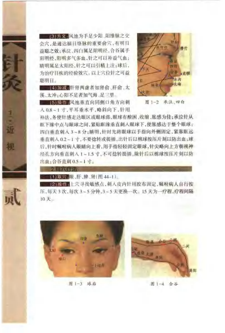 [针灸治疗常见病证图解-五官科分册].张建华.扫描版.pdf 第5页
