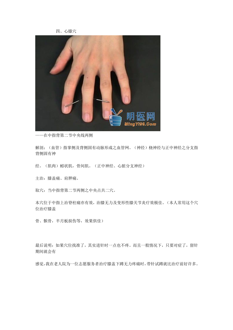 董氏奇穴真人扎针配图.doc 第4页