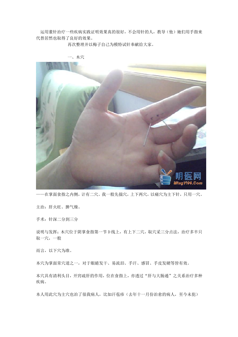 董氏奇穴真人扎针配图.doc 第1页