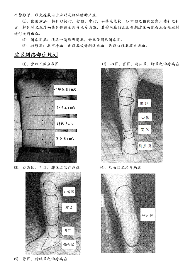 董氏针灸全集验证.doc 第3页