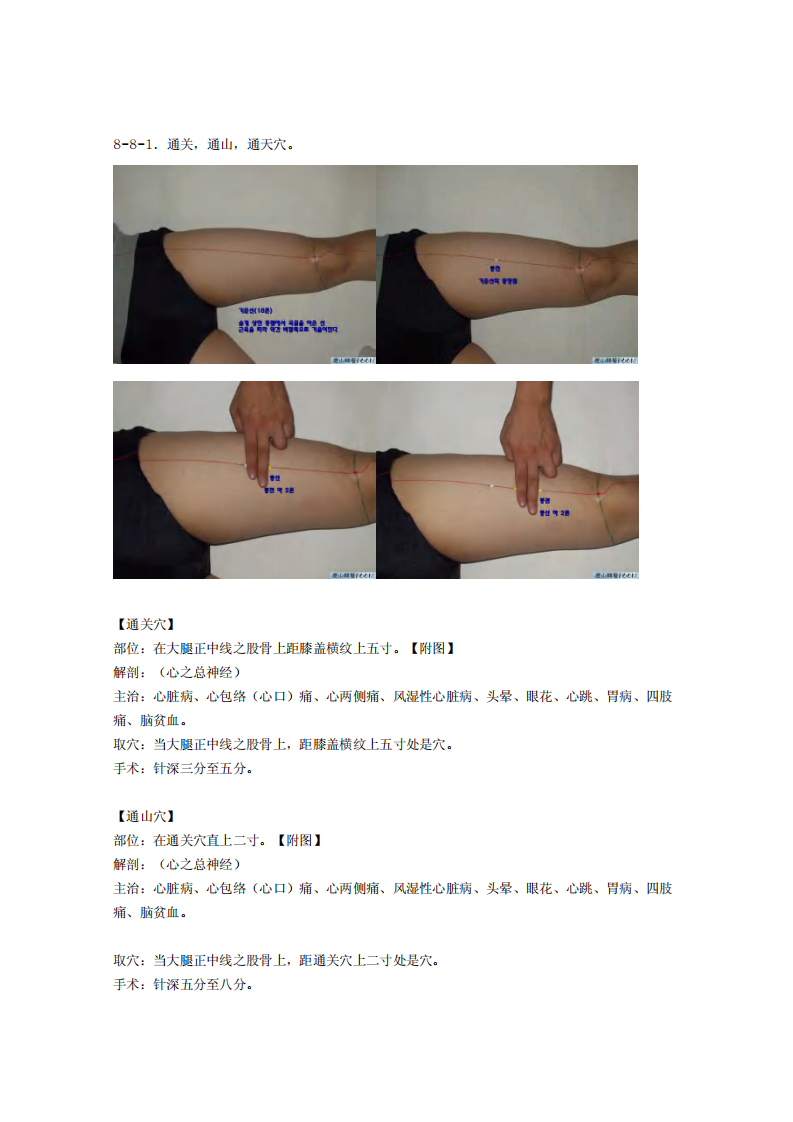 童氏奇穴发挥整理8-8.pdf 第1页