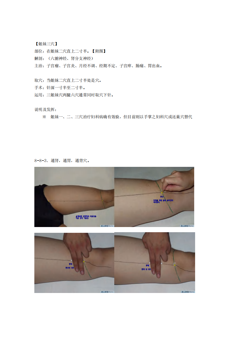 童氏奇穴发挥整理8-8.pdf 第4页