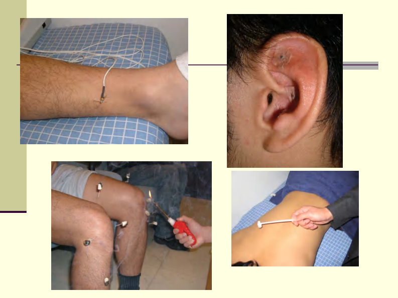 针灸镇痛.pdf 第4页