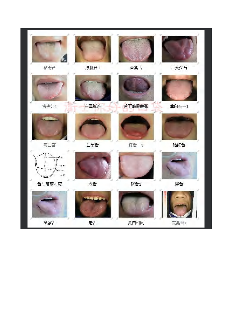 舌诊图谱(精华).pdf 第3页