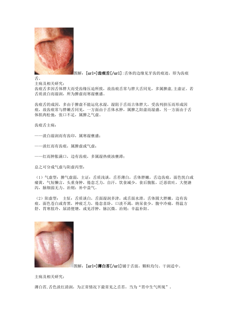 舌诊图谱.doc 第4页