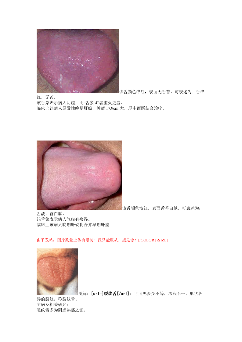 舌诊图谱.doc 第2页