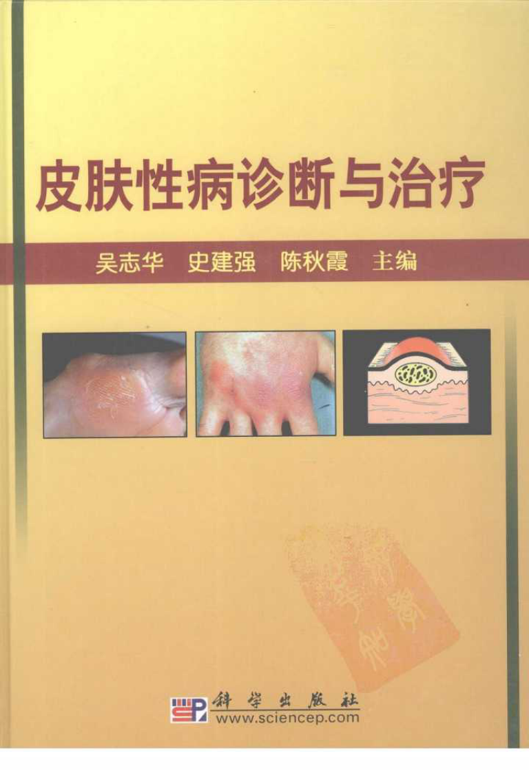 皮肤性病诊断与治疗（全彩高清版）--吴志华 史建强 陈秋霞 主编2008.7出版.pdf 第1页