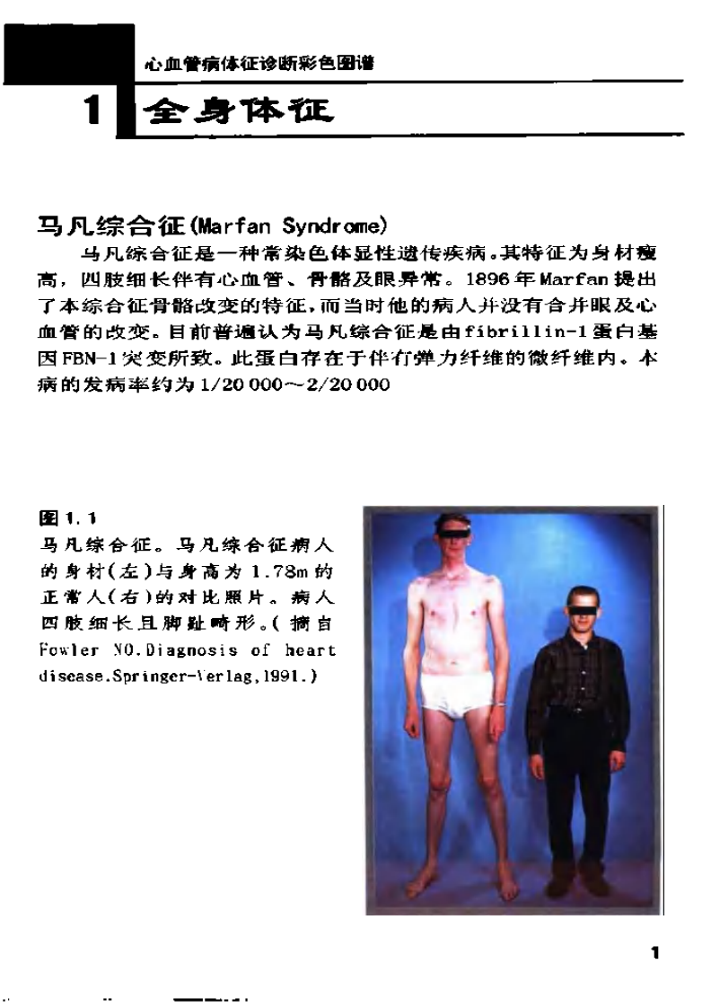 心血管病征诊断彩色图谱..pdf 第2页