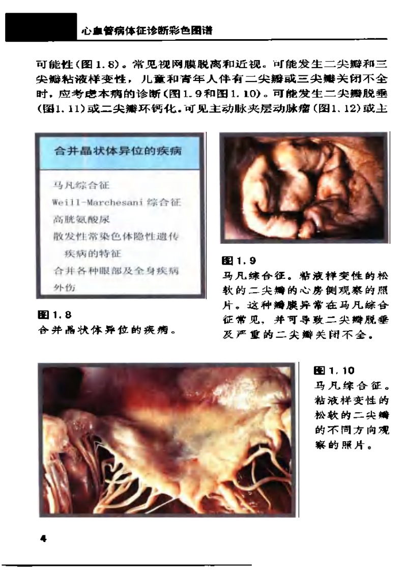 心血管病征诊断彩色图谱..pdf 第5页