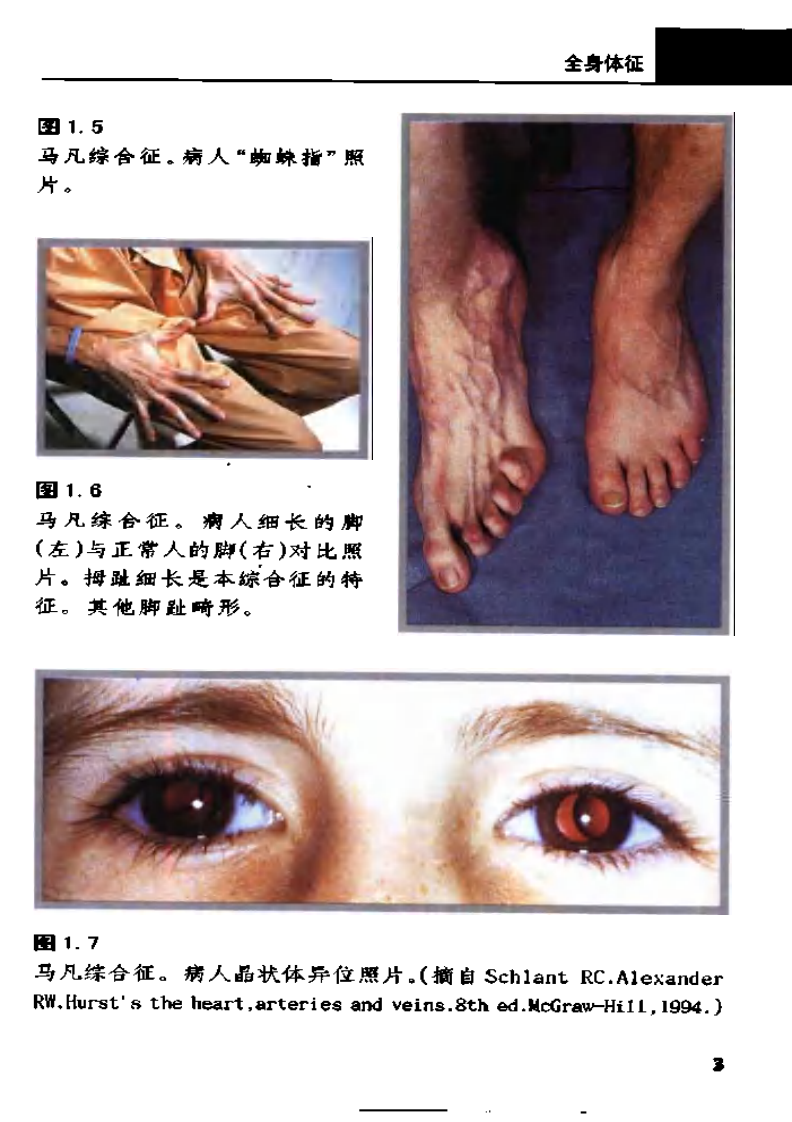 心血管病征诊断彩色图谱..pdf 第4页