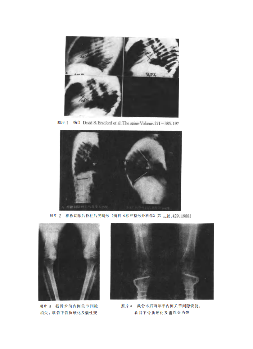 截骨术设计与应用研究.pdf 第3页