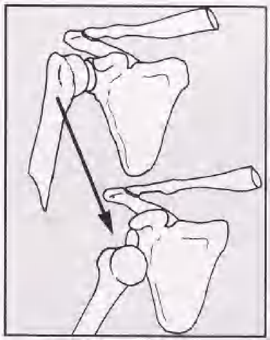 实用骨折治疗学（美）（全图版）.pdf 第4页