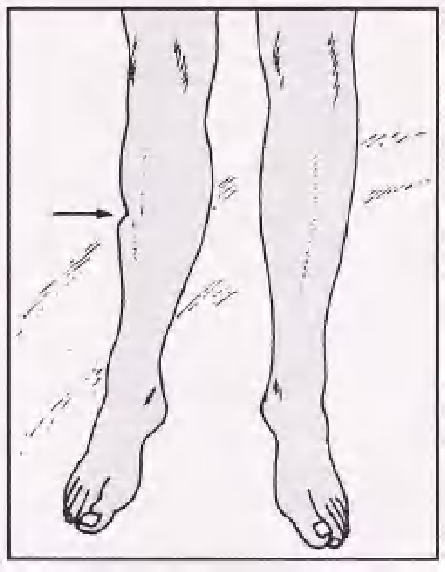 实用骨折治疗学（美）（全图版）.pdf 第3页