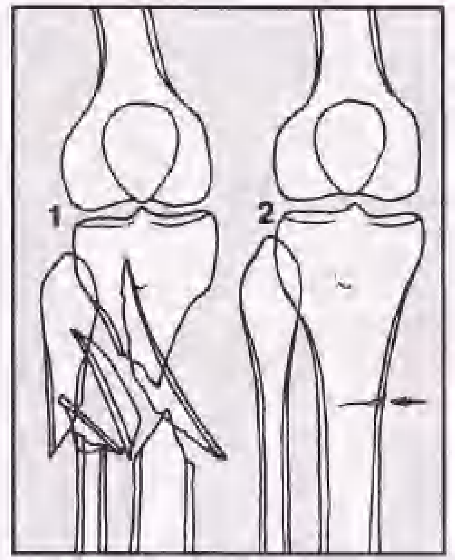 实用骨折治疗学（美）（全图版）.pdf 第1页