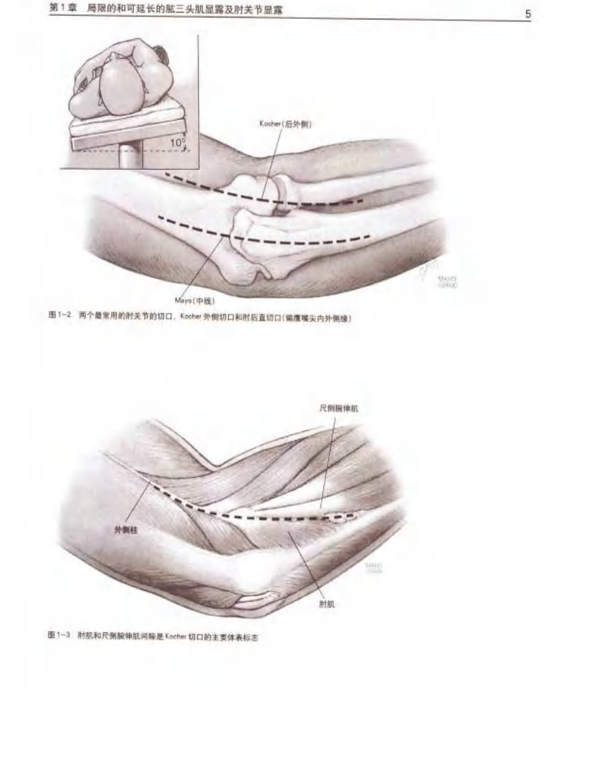 骨科标准手术技术丛书—肘.pdf 第4页