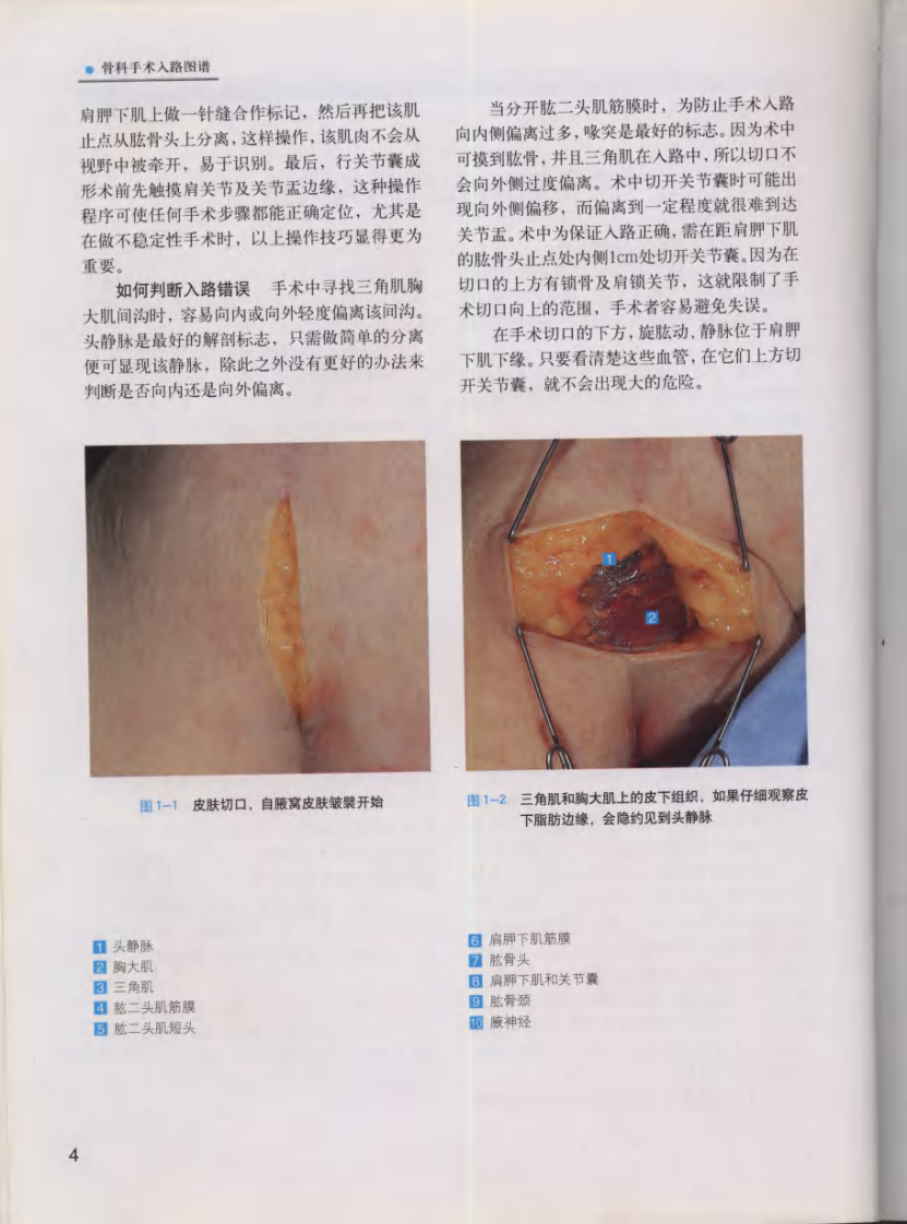 骨科手术入路图谱（中文高清彩图版）.pdf 第4页