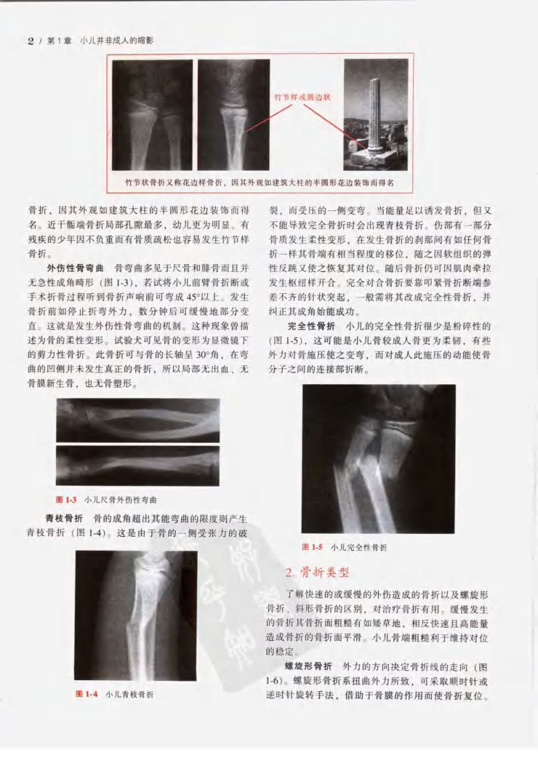 Rang小儿骨折.pdf 第5页