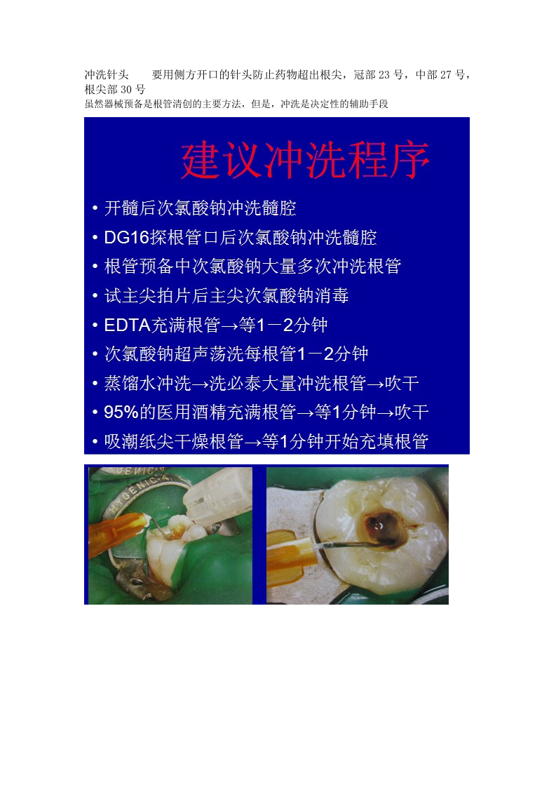 纤维桩和根管冲洗的注意事项.doc 第5页