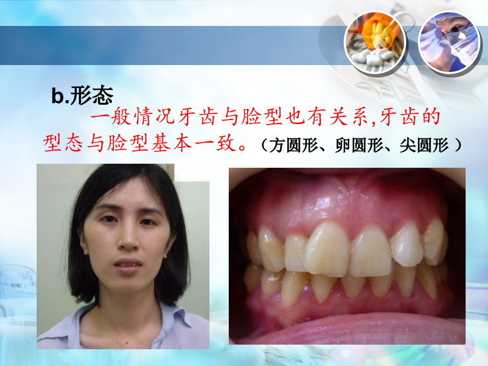 总义齿(四） 排牙.ppt 第4页