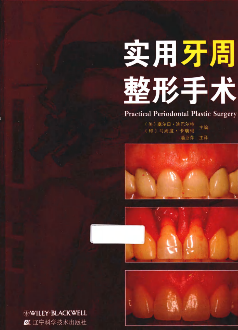 283实用牙周整形手术_潘亚萍2013译（彩图）_.pdf 第1页