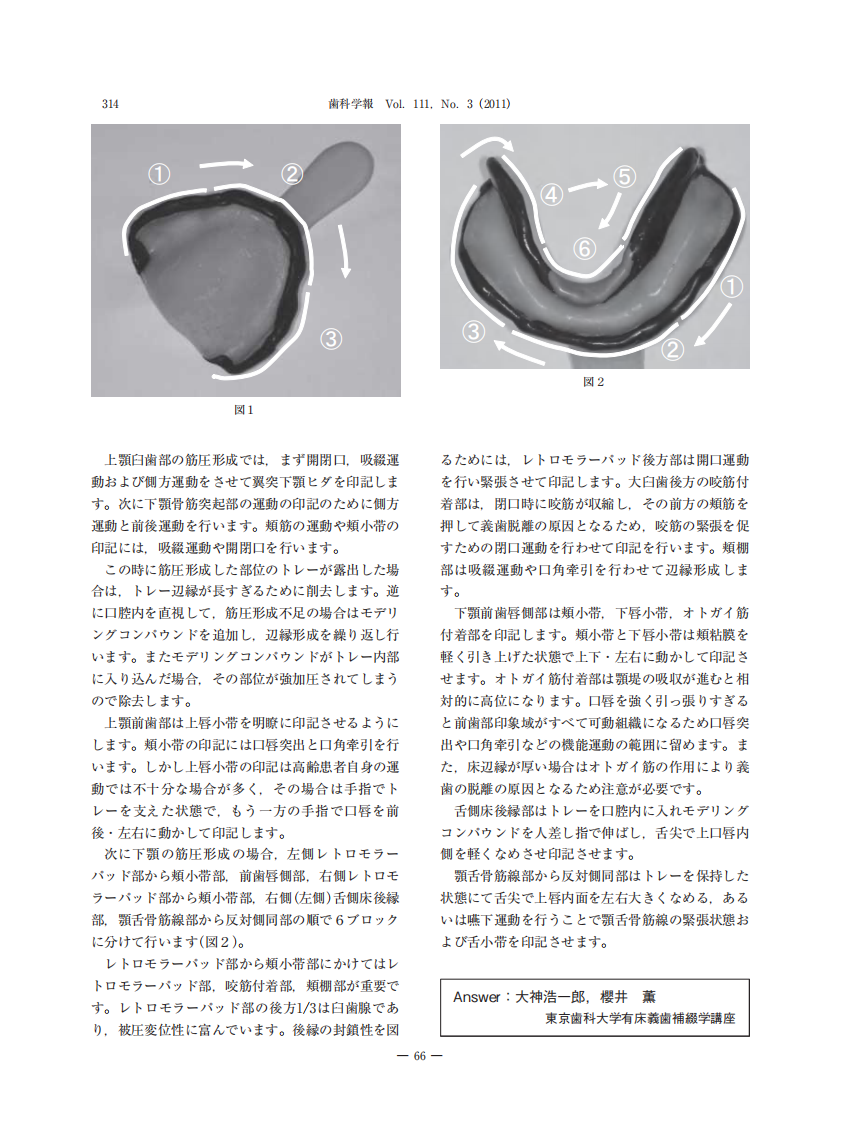 关于无牙颌印模的肌功能修整.pdf 第3页