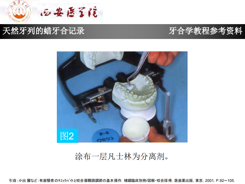 天然牙列的蜡牙合记录.pdf 第3页