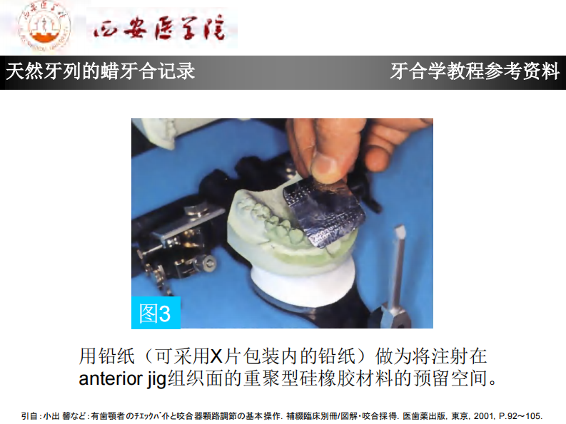 天然牙列的蜡牙合记录.pdf 第4页