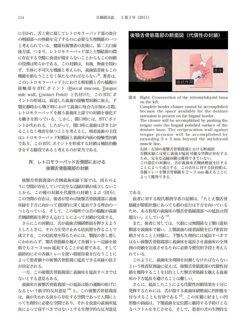 下颌吸着式义齿的制作.pdf 第5页