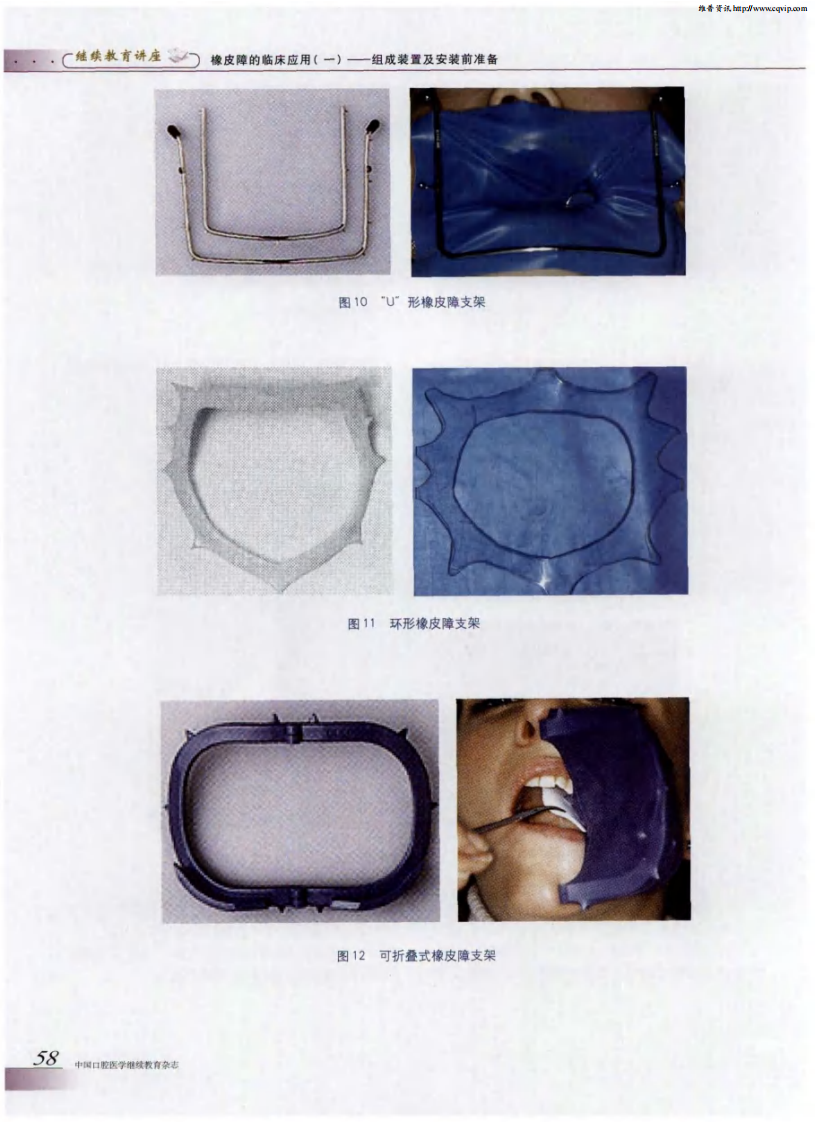 橡皮障的临床应用（一）——组成装置及安装前准备.pdf 第5页