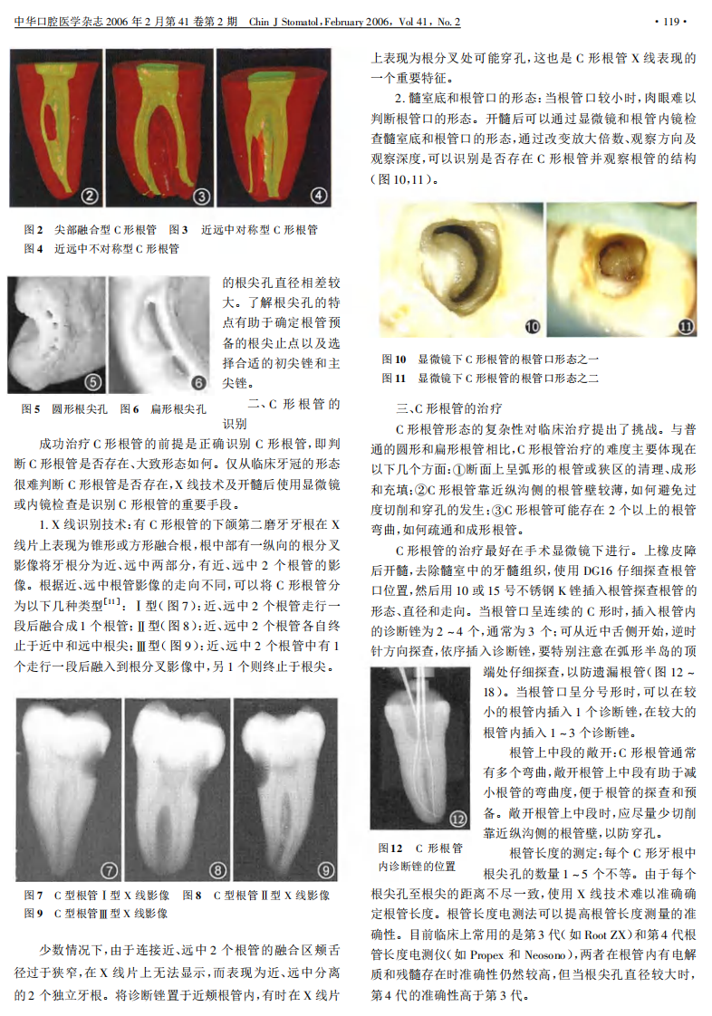 牙体牙髓临床治疗Ⅰ.C形根管的形态、识别和治疗.pdf 第2页